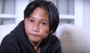 Fajar Sadboy Ungkap Kondisi Pasca Kecelakaan Motor, Syukuri Kesempatan Kedua dalam Hidup