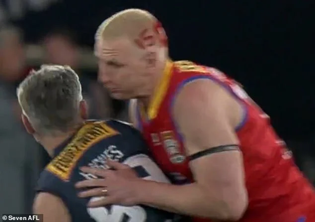 Krisis Kesehatan Mental Elijah Hollands Mengguncang Carlton: Komentar Dave Hughes, Tanggapan Klub, dan Dampaknya pada AFL