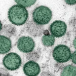 Virus Hantavirus: Ancaman Baru yang Mengintai di Pacific Northwest
