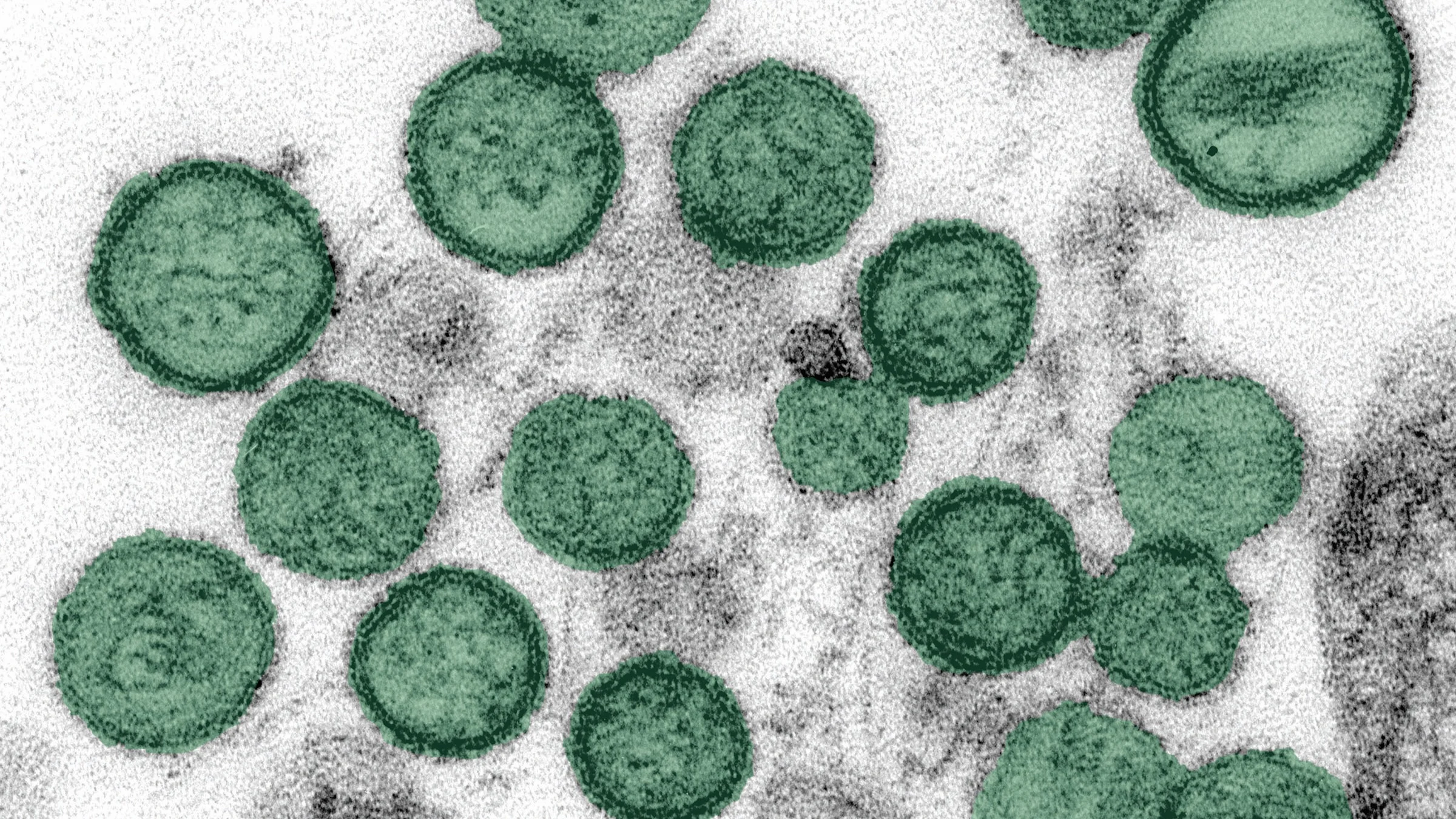 Virus Hantavirus: Ancaman Baru yang Mengintai di Pacific Northwest