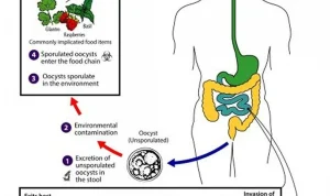 Pembaharuan Terkini: Cyclosporiasis, Testosterone, dan Kesehatan Kulit