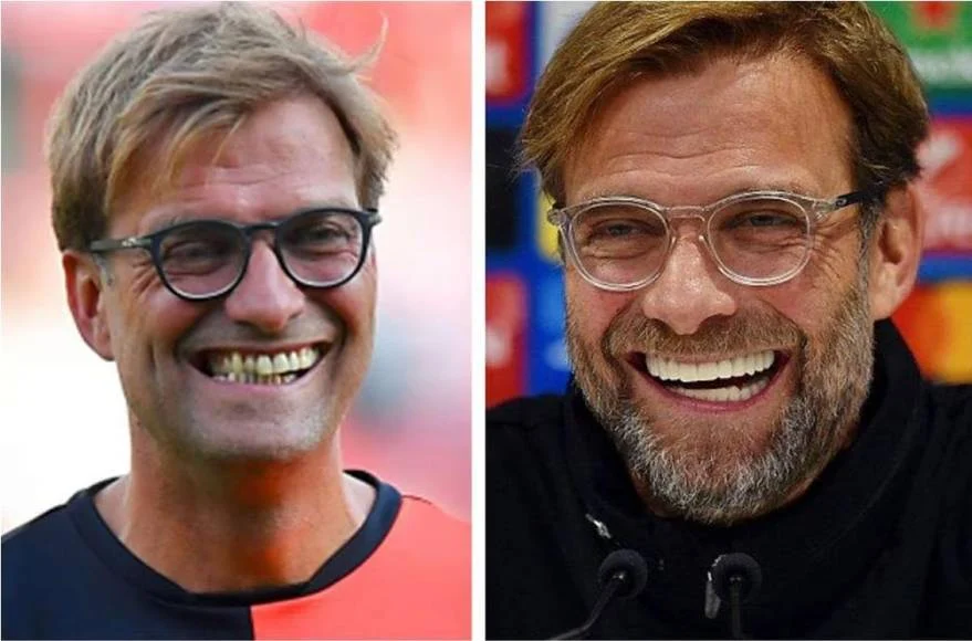 Jürgen Klopp: Dari Masa Kecil Hingga Menjadi Bundestrainer Jerman